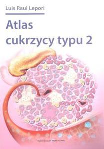 Atlas cukrzycy typu 2 - 2845616158