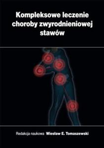 Kompleksowe Leczenie Choroby Zwyrodnieniowej Staww - 2853336743