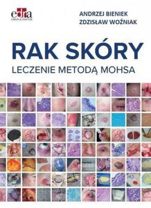 Rak skry Leczenie metod Mohsa - 2860971869