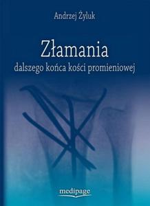 Zamania dalszego koca koci promieniowej - 2860972402