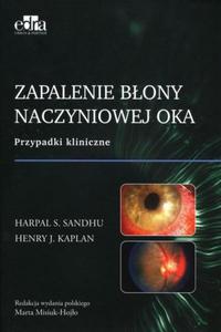 Zapalenie bony naczyniowej oka Przypadki kliniczne - 2871580532