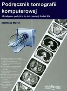 Podrcznik tomografii komputerowej Metodyczne podejcie do interpretacji bada TK - 2868705999