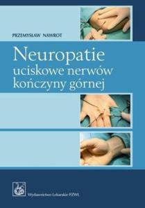 Neuropatie uciskowe nerww koczyny grnej - 2868706048