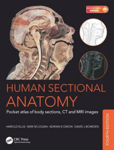 Human Sectional Anatomy - 2878874695