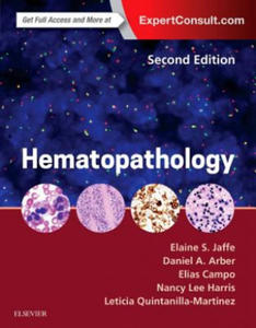 Hematopathology - 2874792296
