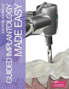 Guided Implantology Made Easy - 2867128005