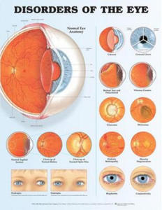 Disorders of the Eye Anatomical Chart - 2871603228