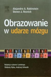 Obrazowanie w udarze mozgu - 2877503061