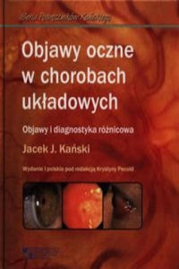 Objawy oczne w chorobach ukladowych - 2876334615