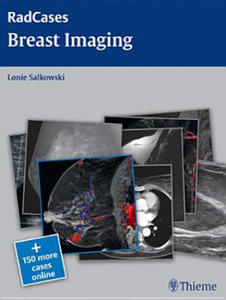 Radcases Breast Imaging - 2861885265