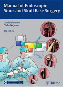 Manual of Endoscopic Sinus and Skull Base Surgery - 2861996873