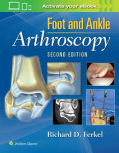 Foot & Ankle Arthroscopy - 2878787197