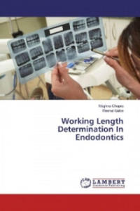 Working Length Determination In Endodontics - 2877621753