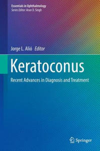 Keratoconus - 2862008560