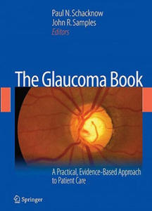 Glaucoma Book - 2862011960