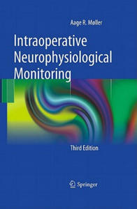 Intraoperative Neurophysiological Monitoring - 2873172838