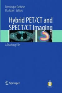 Hybrid PET/CT and SPECT/CT Imaging - 2861955844