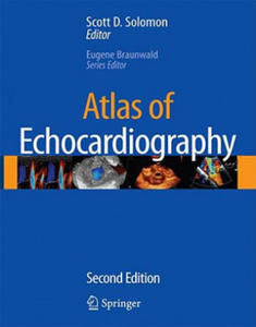 Atlas of Echocardiography - 2866658378