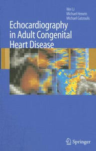 Echocardiography in Adult Congenital Heart Disease - 2878322435