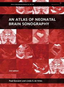 Atlas of Neonatal Brain Sonography - Clinics in Developmental Medicine - 2868250121