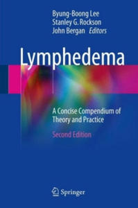 Lymphedema - 2877630327