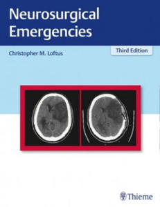 Neurosurgical Emergencies - 2877410321
