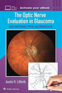 Optic Nerve Evaluation in Glaucoma - 2878790131