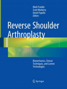 Reverse Shoulder Arthroplasty - 2866669247