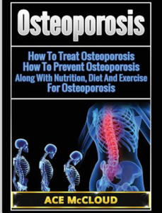 Osteoporosis - 2875681634