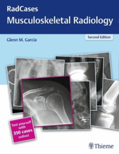 RadCases Q&A Musculoskeletal Radiology - 2861887669