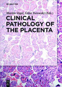 Clinical Pathology of the Placenta - 2875805187