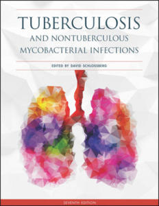 Tuberculosis and Nontuberculous Mycobacterial Infections, - 2876545560