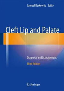 Cleft Lip and Palate - 2878321039