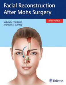 Facial Reconstruction After Mohs Surgery - 2874291896