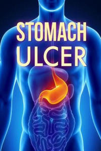 Stomach Ulcer: Treatment in 60 days!: Stomach Ulcer treatment - 2867770135