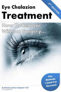 Eye Chalazion: How To Remove Without Surgery: My personal experience and the methods I used for success - 2867916392