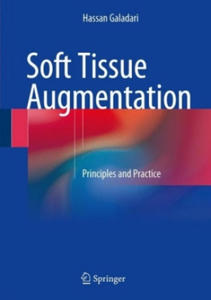 Soft Tissue Augmentation - 2865204467