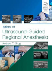 Atlas of Ultrasound-Guided Regional Anesthesia - 2870490465