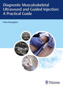 Diagnostic Musculoskeletal Ultrasound and Guided Injection: A Practical Guide - 2876335468