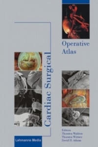 Cardiac Surgical Operative Atlas - 2878162433