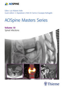 AOSpine Masters Series, Volume 10: Spinal Infections - 2862288313
