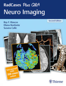 RadCases Plus Q&A Neuro Imaging - 2861888835