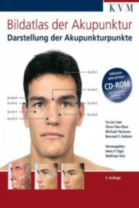 Bildatlas der Akupunktur, m. CD-ROM - 2878798376