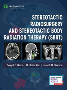 Stereotactic Radiosurgery and Stereotactic Body Radiation Therapy (SBRT) - 2861918074