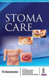 Stoma Care - 2872534671