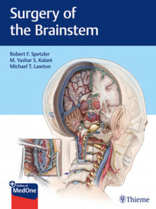 Surgery of the Brainstem - 2871150056