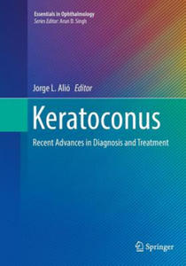 Keratoconus - 2867769192