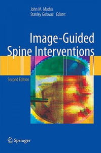 Image-Guided Spine Interventions - 2874789563