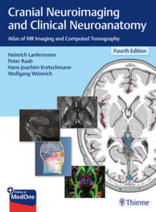 Cranial Neuroimaging and Clinical Neuroanatomy - 2873019802