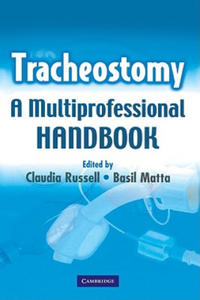 Tracheostomy - 2867164907